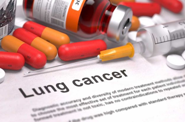 lung cancer- health insurance Health Insurance for lung cancer